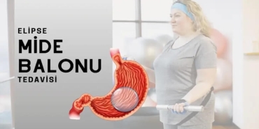 Yutulabilir Mide Balonu